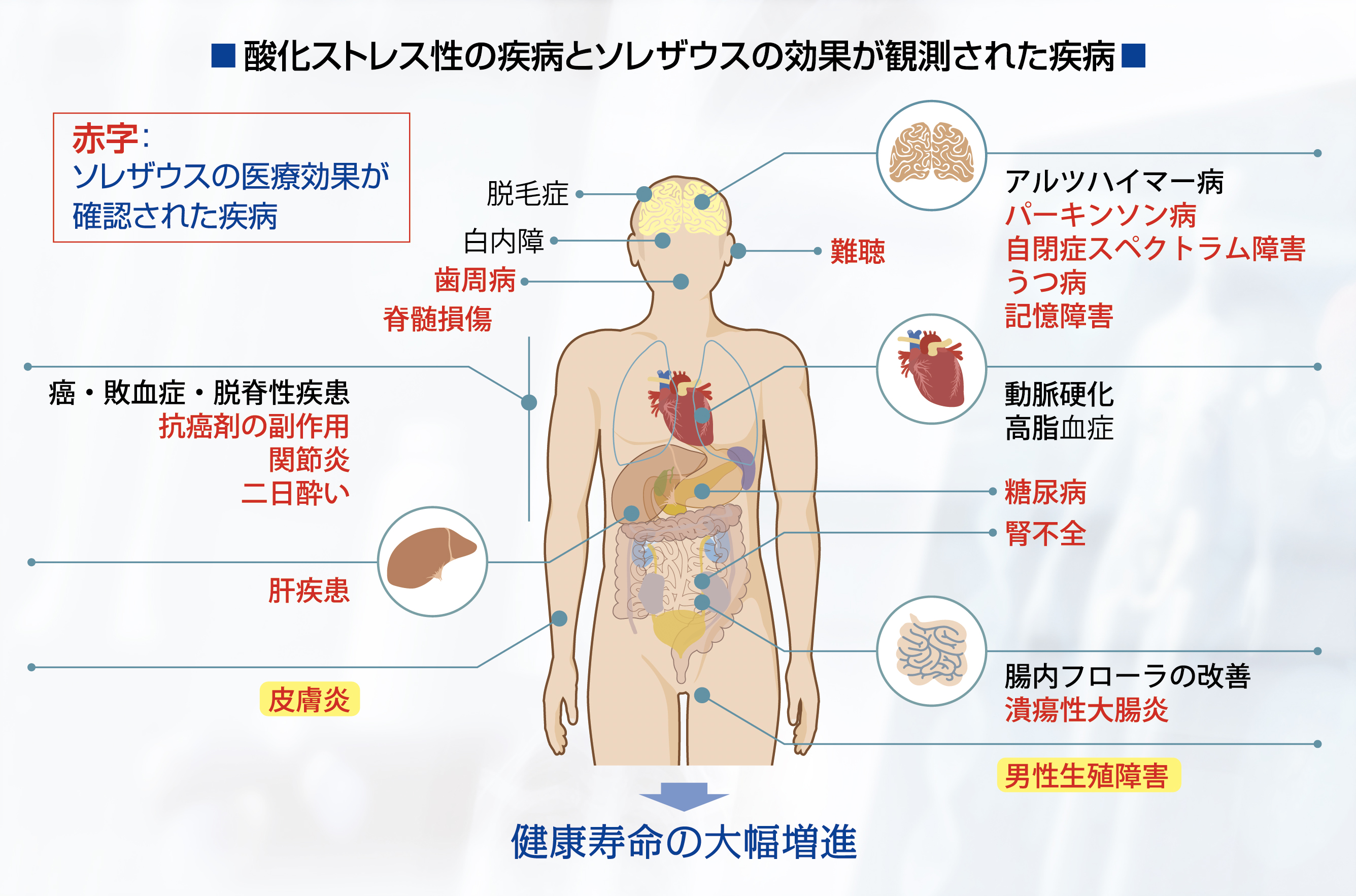 酸化ストレス性の疾病とそれザウスの効果が観測された疾病